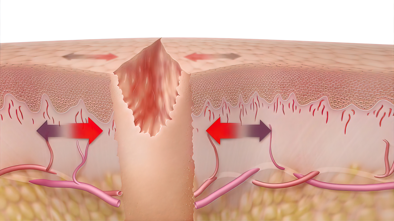 千库网_皮肤伤口愈合时候的-3D-医学插图_拍照图编号16624738.png